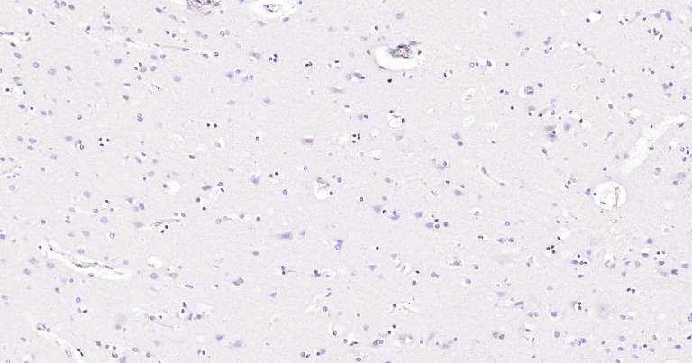 人细胞角蛋白18即用型免疫组化试剂盒-IHC0249H